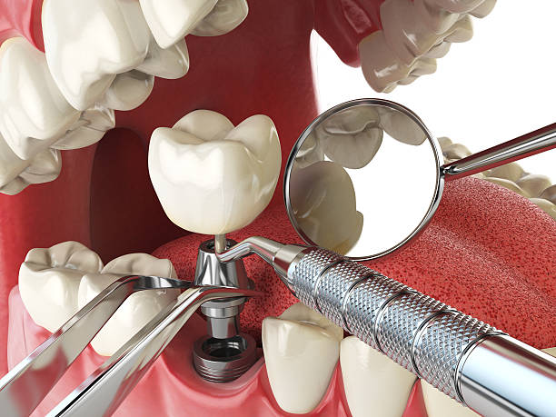 Best Emergency Dentist Open Today  in La Palma, CA